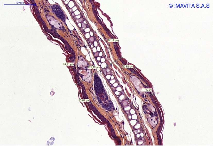 Psoriasis models / Imavita / Efficacy preclinical CRO