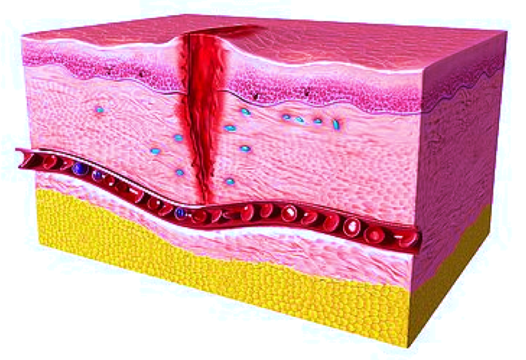 Wound Healing Models Imavita