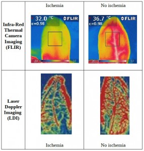 LDI vs. IR thermal imaging in ischemic skin wound healing models