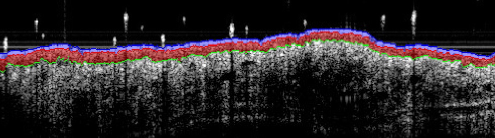 Imavita OCT imaging