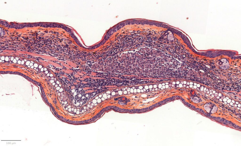 C. acnes Acne Model • Imavita • Preclinical efficacy CRO